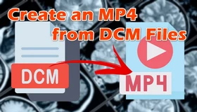 Convert DCM Files to MP4